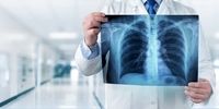 رادیوگرافی قفسه سینه به چه منظوری انجام می گیرد؟